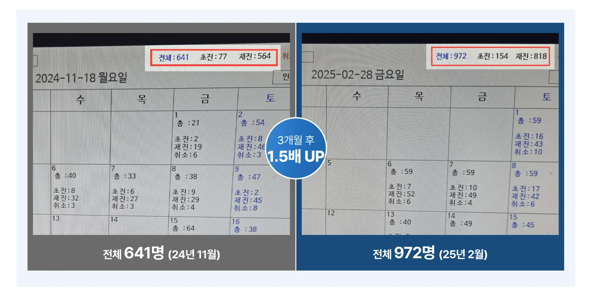 상승기획 마케팅 시작 3개월 후 병원 신규 환자 수가 1.5배로 증가한 전후 비교 그래프